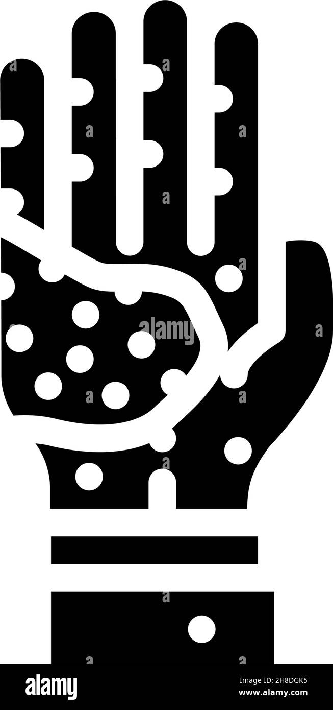 Abbildung des Symbols für atopische Dermatitis Glyphe Stock Vektor