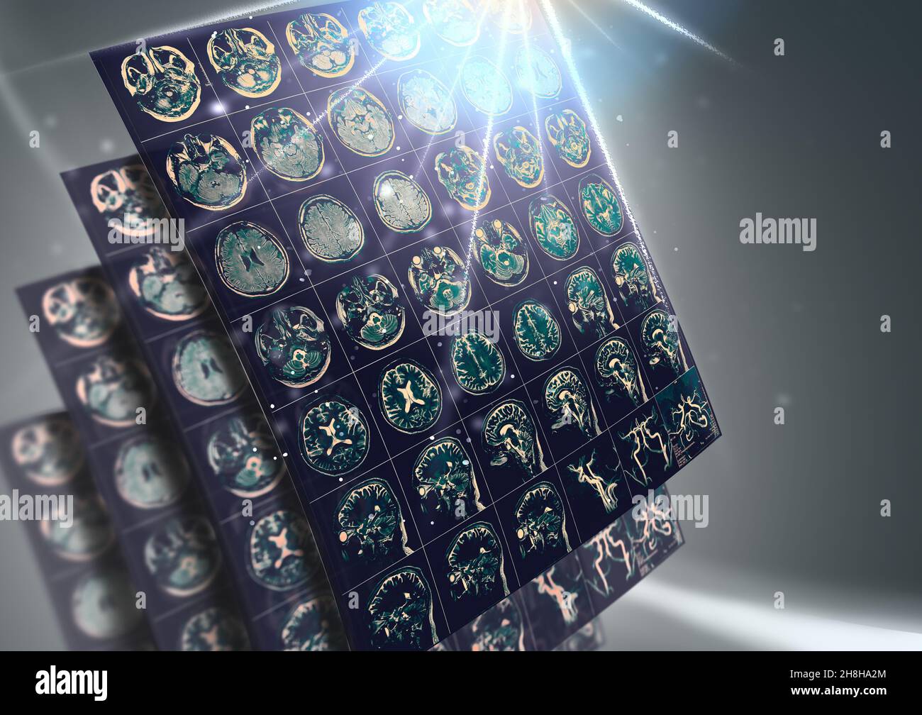 CT-Scan-Ergebnis eines menschlichen Gehirns als Konzept für die zukünftige Gesundheit. Stockfoto