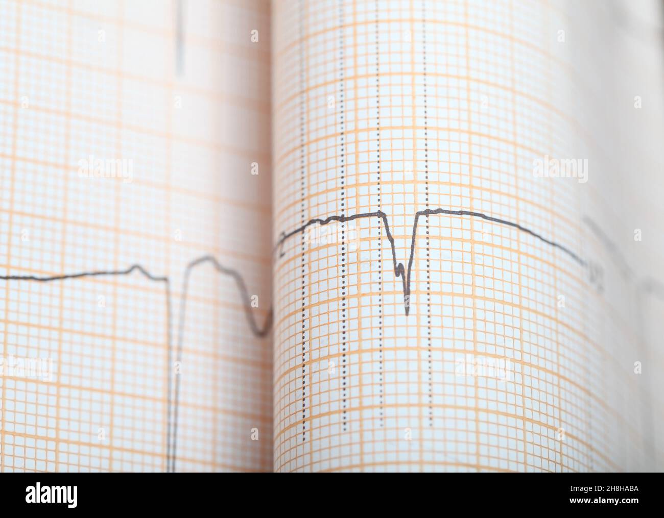 EKG-Diagrammpapier als Gesundheitshintergrund mit Platz für die Einfügung. Stockfoto