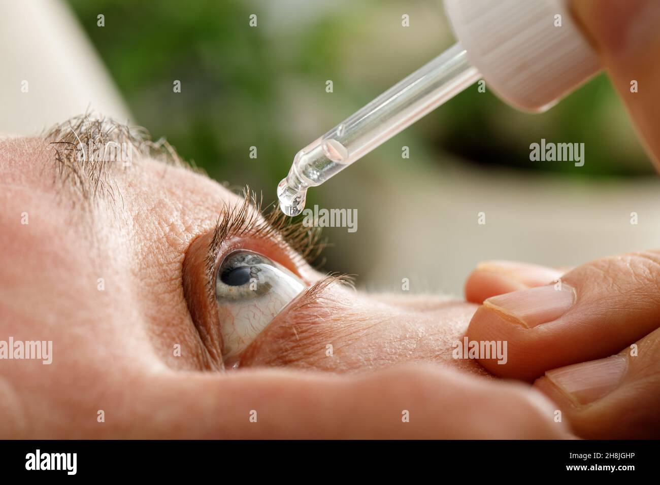 Ein Mann befeuchtet seine Augen, bevor er Kontaktlinsen einführt. Tropfen in den Augen durch Reizungen, Rötungen und Allergien. Stockfoto