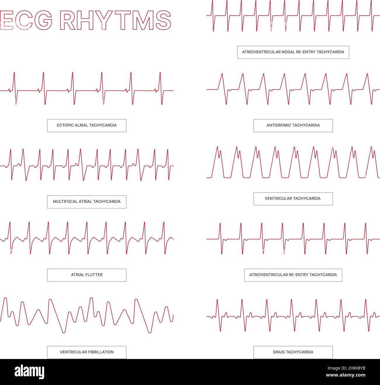 EKG-Vorlagen. Medizinische Infografik Linien Herzrhythmusstörungen Gesundheit konzeptionelle Bilder für Ärzte Info grelle Vektor-ekg-Illustrationen Stock Vektor