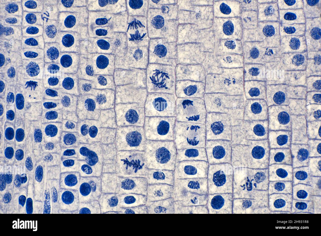 Mitose der Zwiebelwurzelspitze, Zellteilung, Hellfeld-Photomikrograph Stockfoto