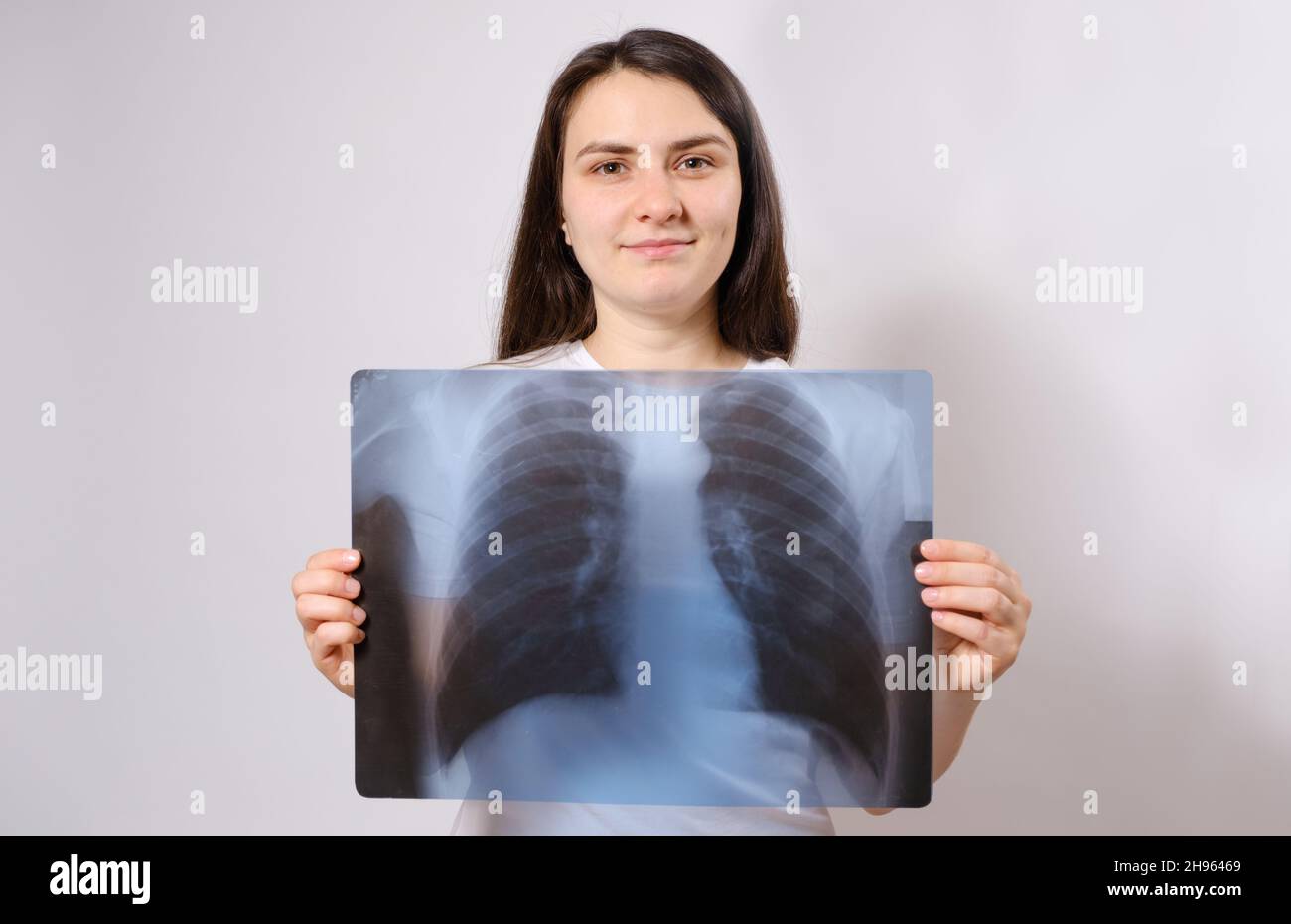 Die Frau hält ein Röntgenbild ihrer Lunge auf Brusthöhe Stockfoto