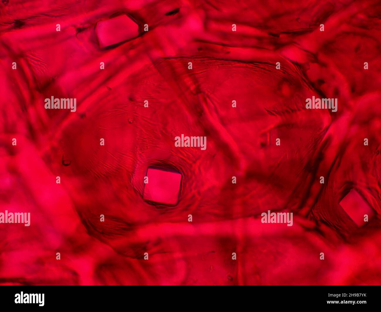 Rote Zwiebelhaut mit Oxalatkristallen unter dem Mikroskop, horizontales Sichtfeld ist etwa 0,24mm Stockfoto
