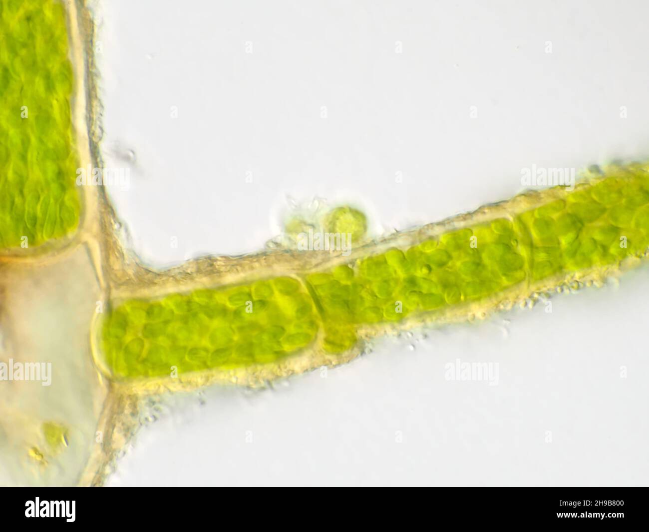 Pflanzenzellen unter dem Mikroskop, die Chlorophyllgehalt zeigen Stockfoto