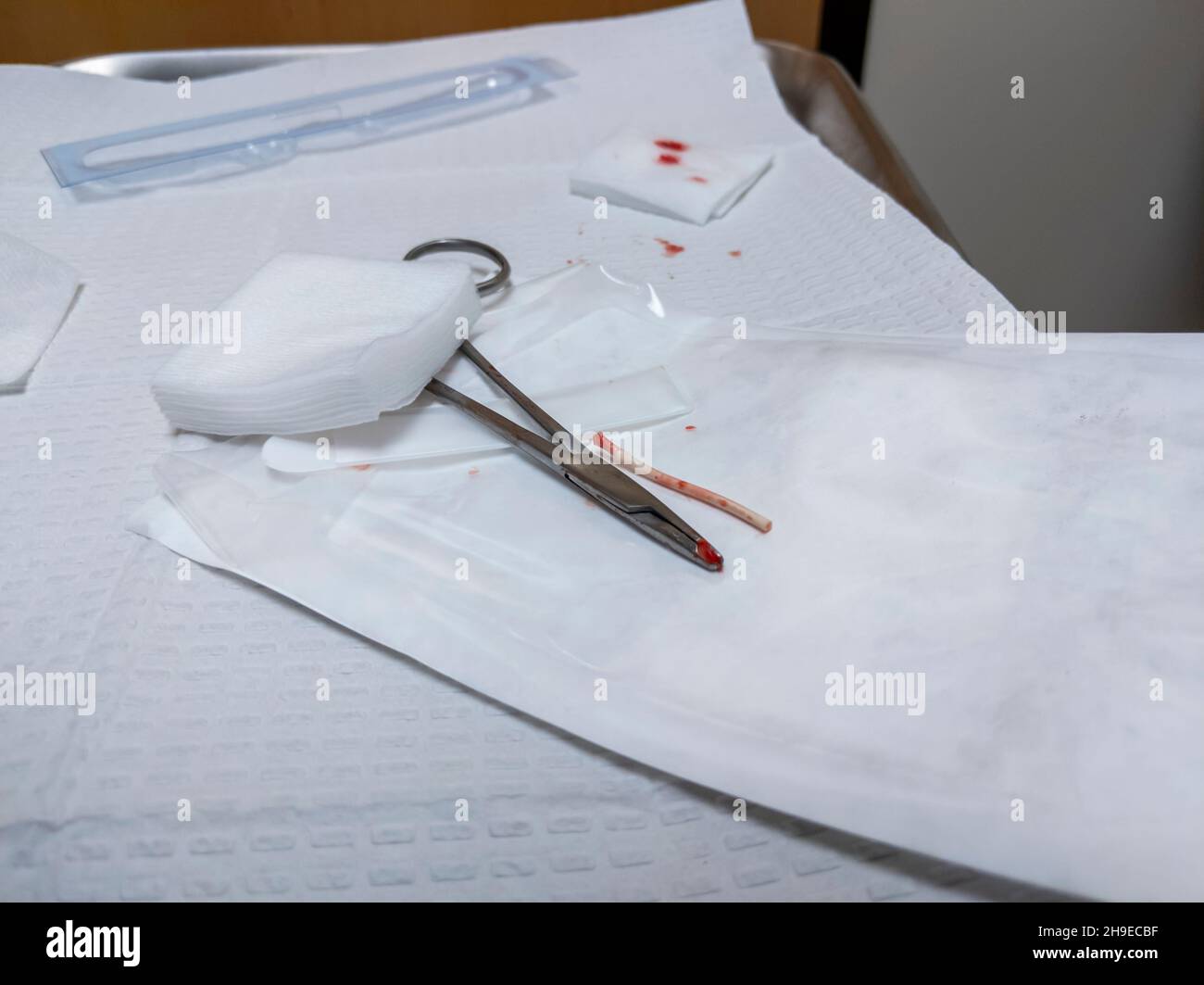 Blick auf ein Implantat eines Geburtskontrollarms, frisch entfernt, sitzend auf einem medizinischen Tisch mit etwas Gaze Stockfoto