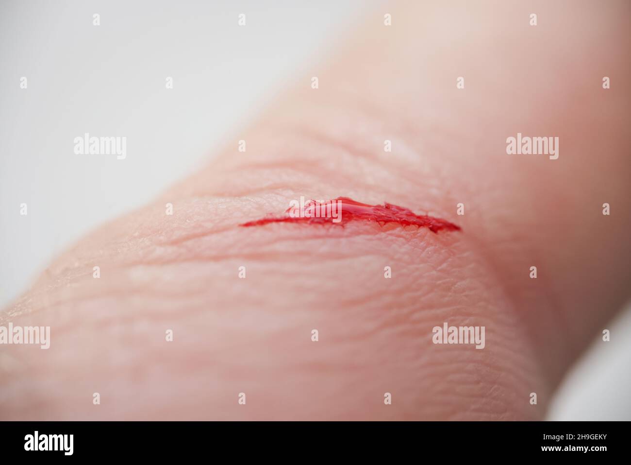 Verletzte Personen Finger mit blutender offener Schnittwunde Stockfoto