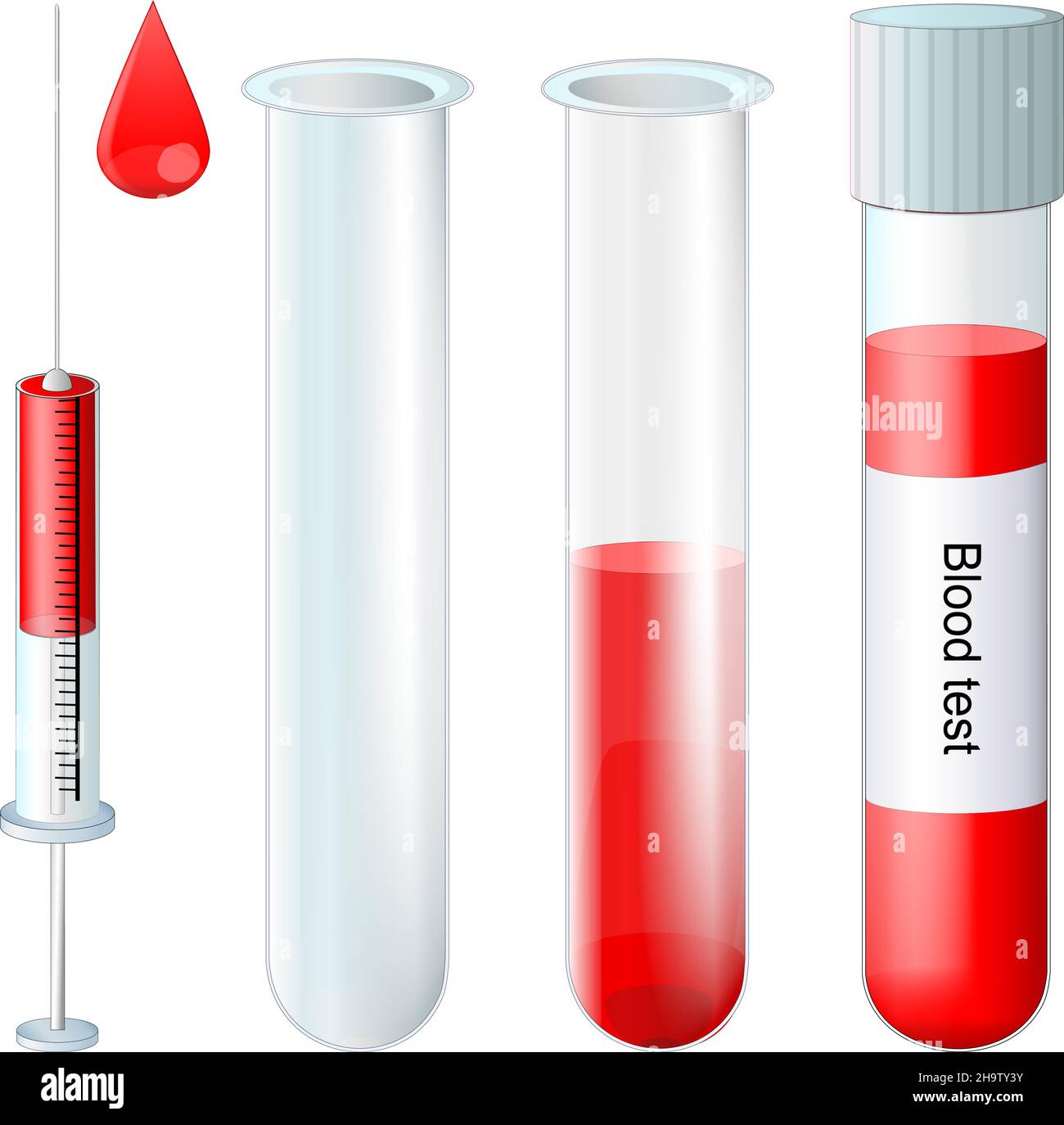 Reagenzglas-Set. Probenröhrchen voll und leer. Laborglas. Probenröhrchen, Blutstropfen und eine Spritze mit einer Nadel. Bluttest für Stock Vektor