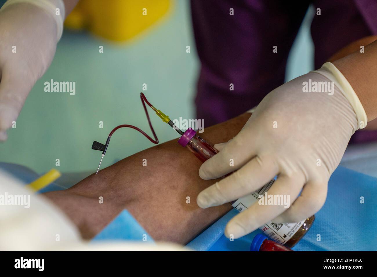 ENSHI, CHINA - 23. JUNI 2020 - Eine Krankenschwester entnimmt Blut aus einer Intensivstation in der Stadt Enshi, Provinz Hubei, China, 23. Juni 2020. Stockfoto