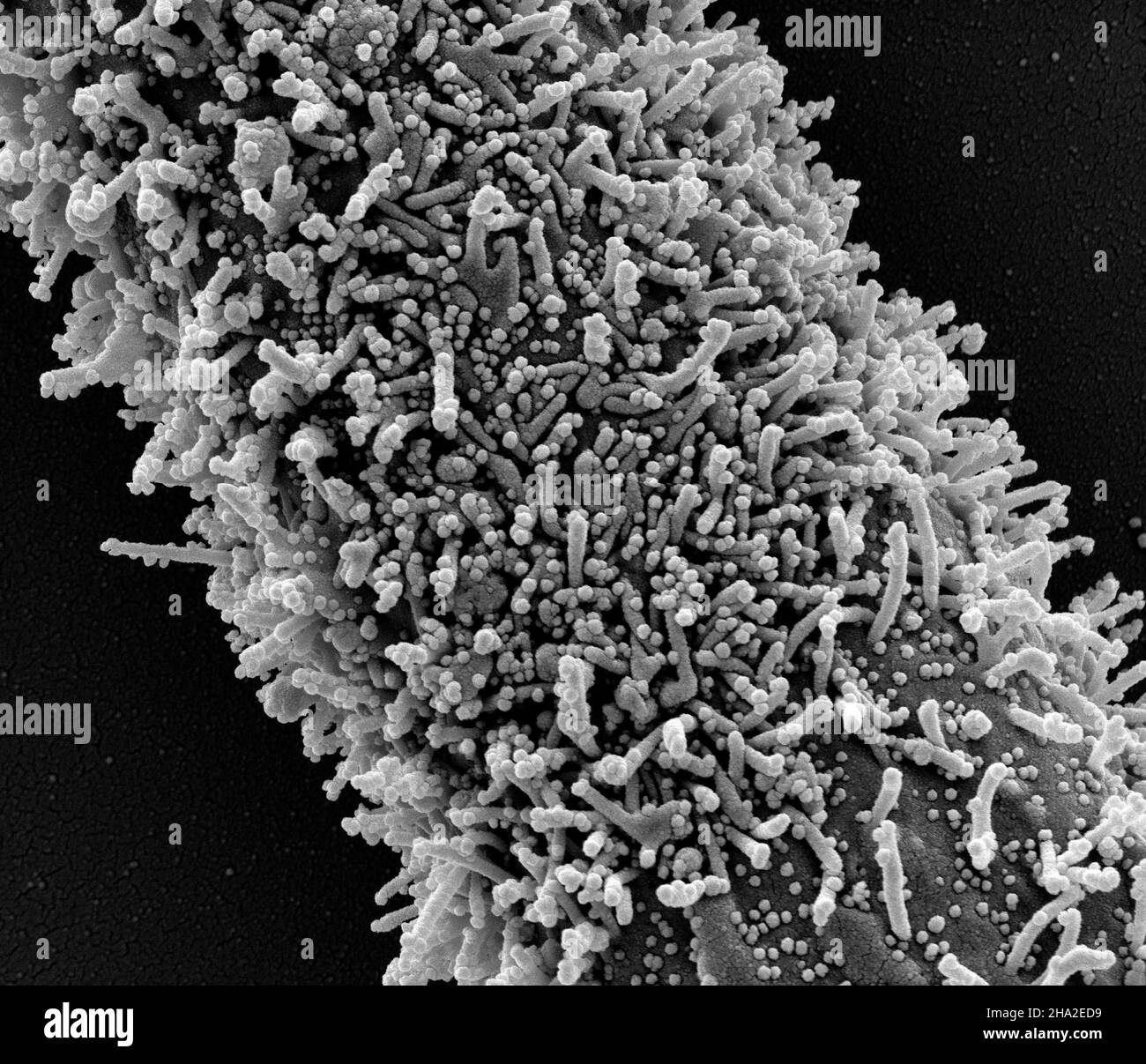 Neuartiges Coronavirus sars-COV-2 Stockfoto