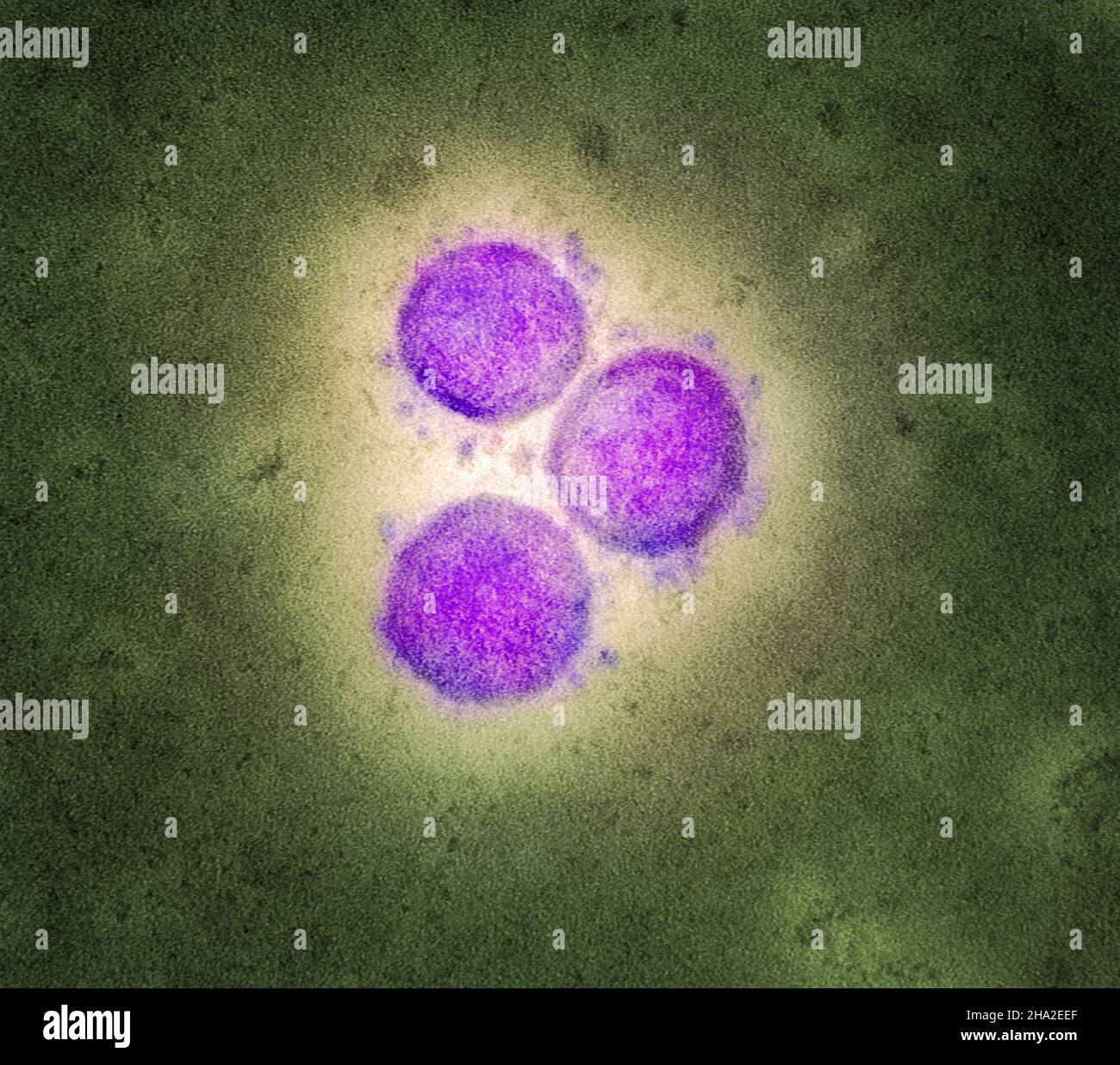 Neuartiges Coronavirus sars-COV-2 Stockfoto