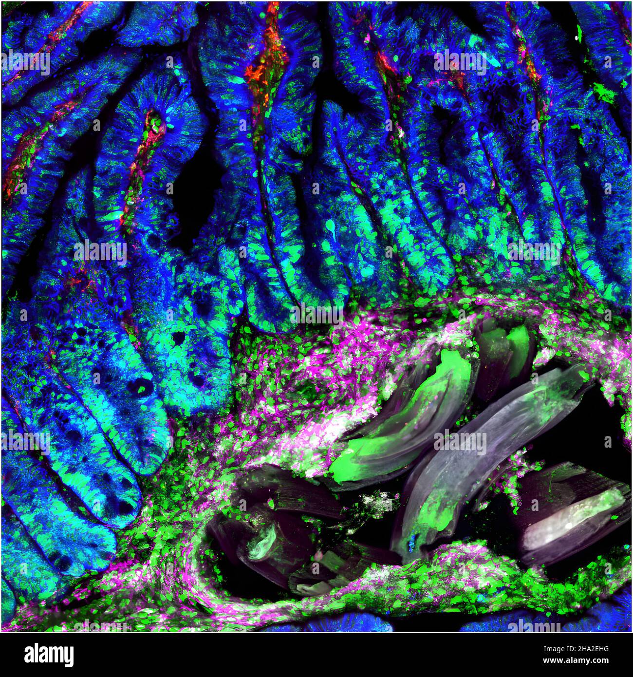 Dünndarm nach h.-Poly-Infektion Stockfoto