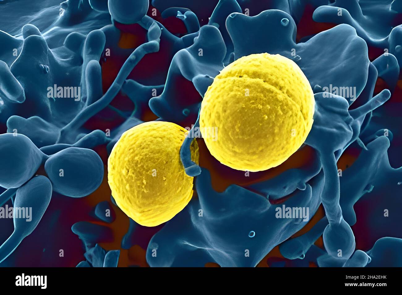 Staphylococcus AureusBakterien Stockfotografie Alamy
