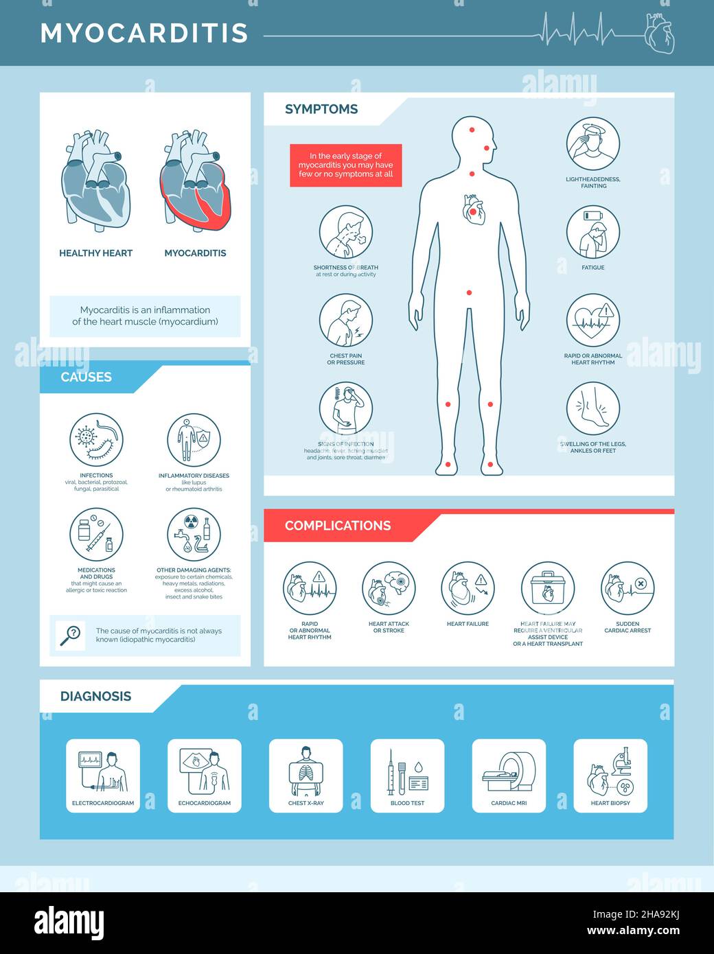 Myokarditis Herzentzündung: Ursachen, Symptome, Komplikationen und Diagnose, medizinische Infografik mit Symbolen Stock Vektor