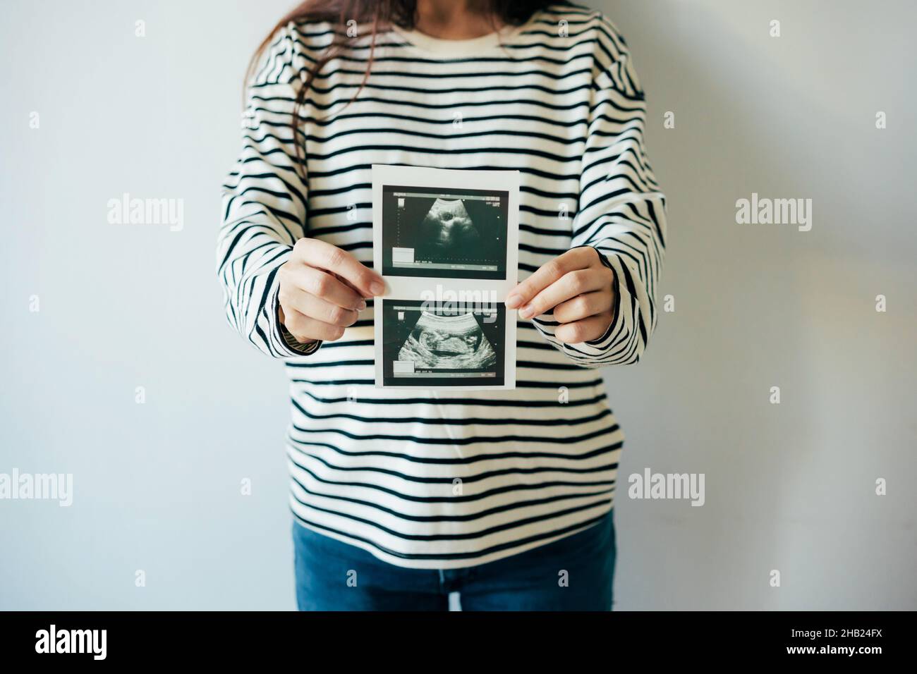 Eine Frau hält in Erwartung der Geburt eines Kindes einen Ultraschalluntersuchung vor sich. Stockfoto