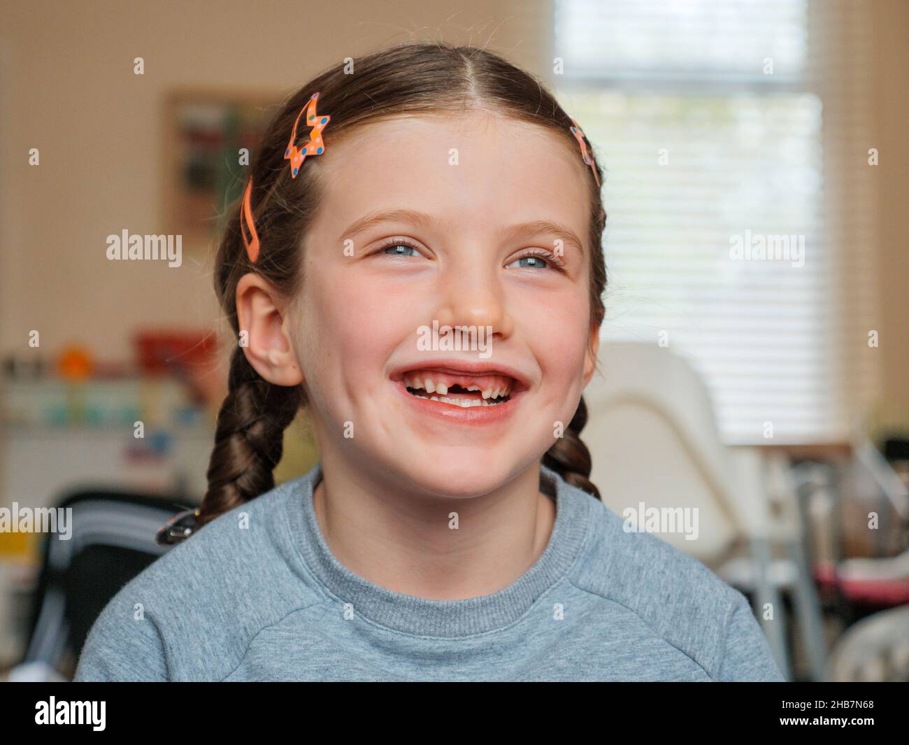 Porträt eines glücklichen lächelnden sieben Jahre alten Mädchens, das ihre Vorderzähne verloren hat, die herausgefallen sind Stockfoto