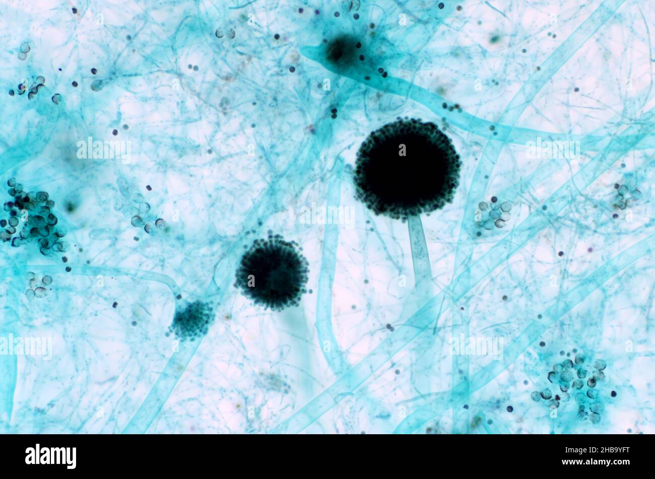 Leichte Mikrographie von Aspergillus sp. Pilz. Stockfoto