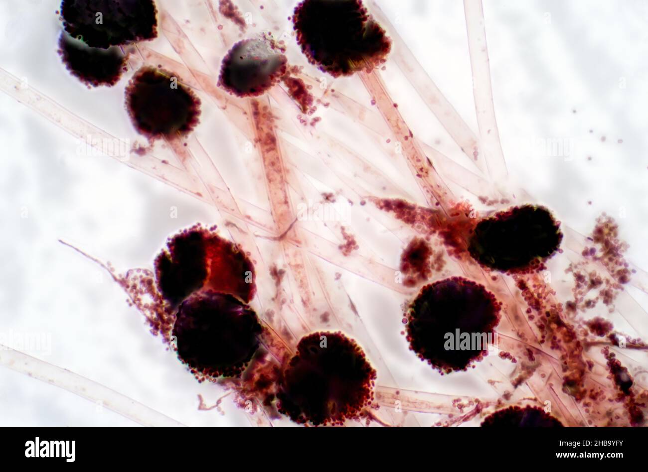 Leichte Mikrographie von Aspergillus sp. Pilz. Stockfoto