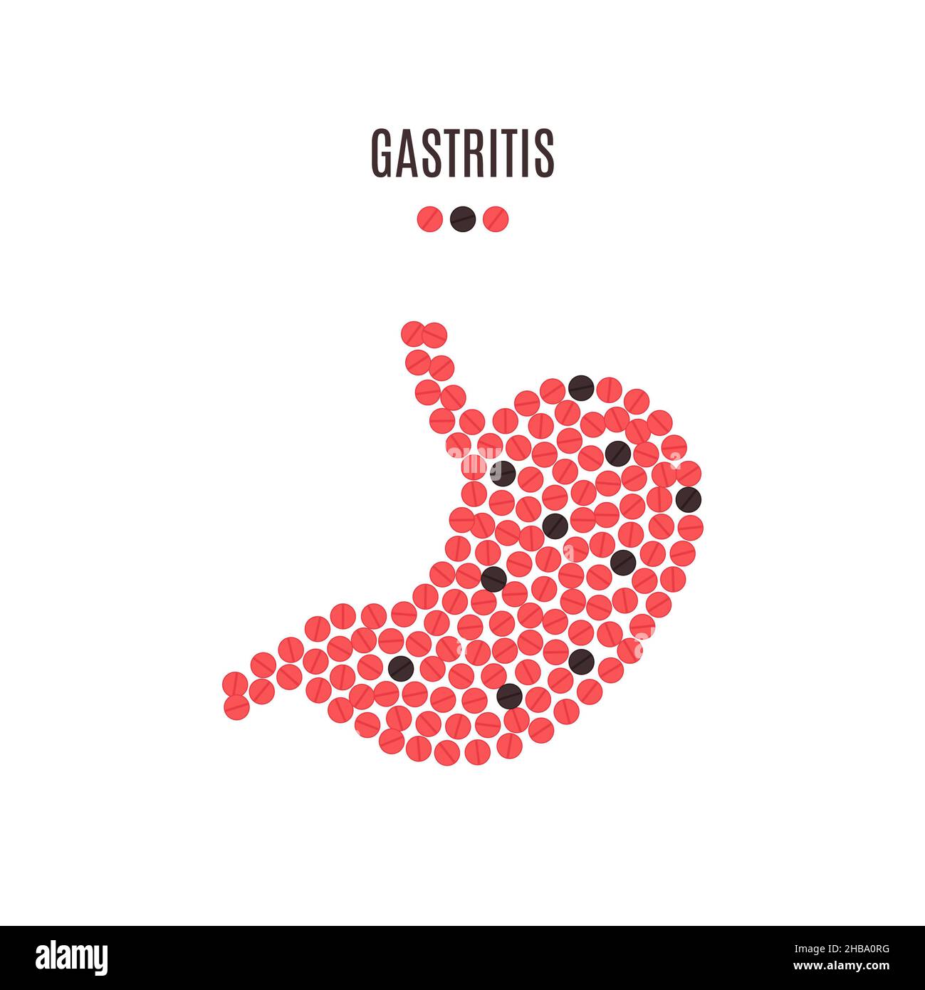 Chronische und akute gastritis Fotos und Bildmaterial in hoher