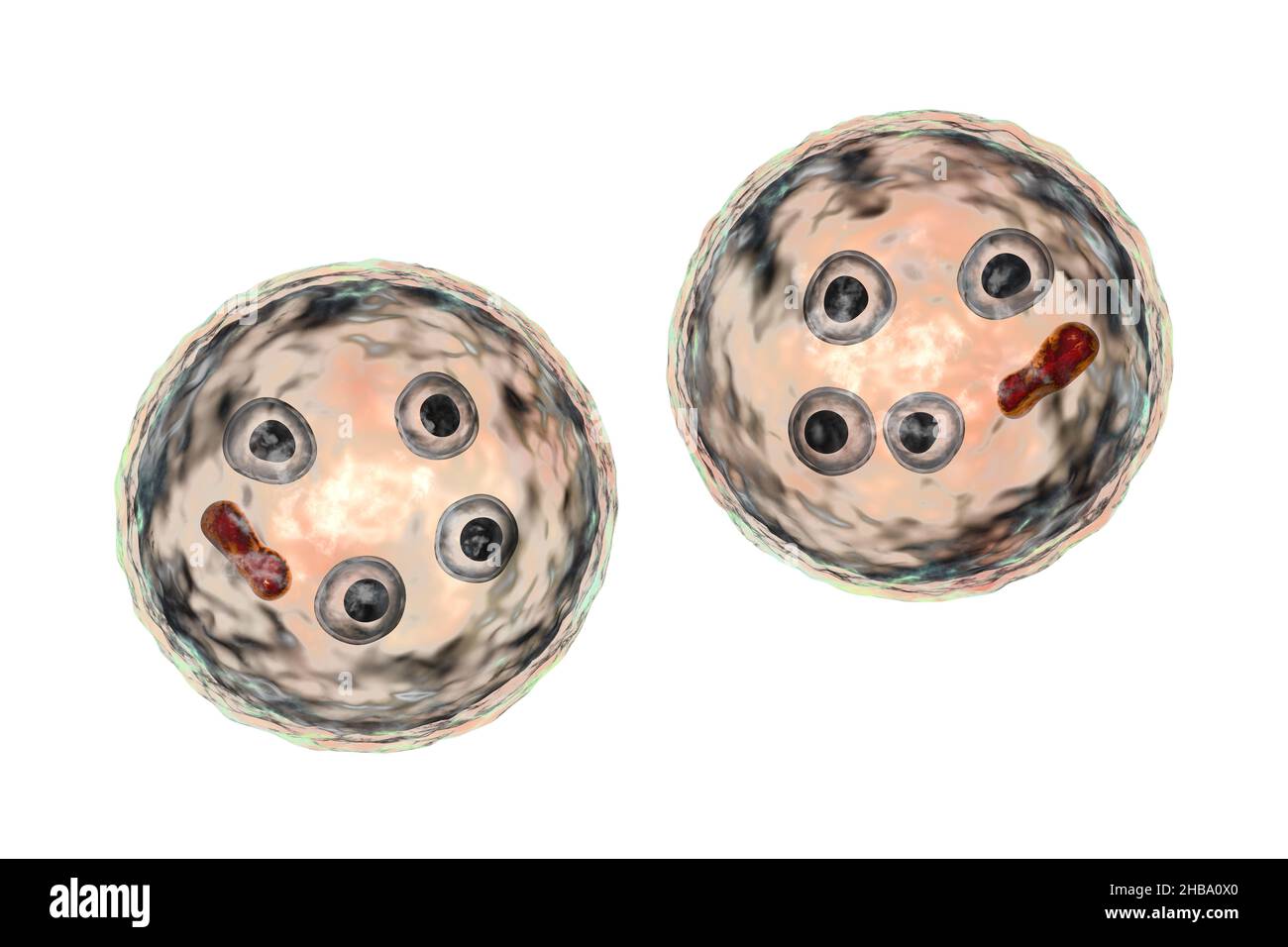 Zysten von Entamoeba histolytica protozoan, Computer-Illustration. Entamoeba histolytica ist ein anaerobes parasitäres Protozoan, das bei Menschen nach der Einnahme von infektiöser Zyste in kontaminierten Lebensmitteln oder Wasser eine amöbische Dysenterie verursacht. Die reife Zyste von E. histolytica ist 10-20 Mikrometer groß, hat vier Kerne und einen gerundeten länglichen chromatoidalen Balken (dunkelrot). Stockfoto