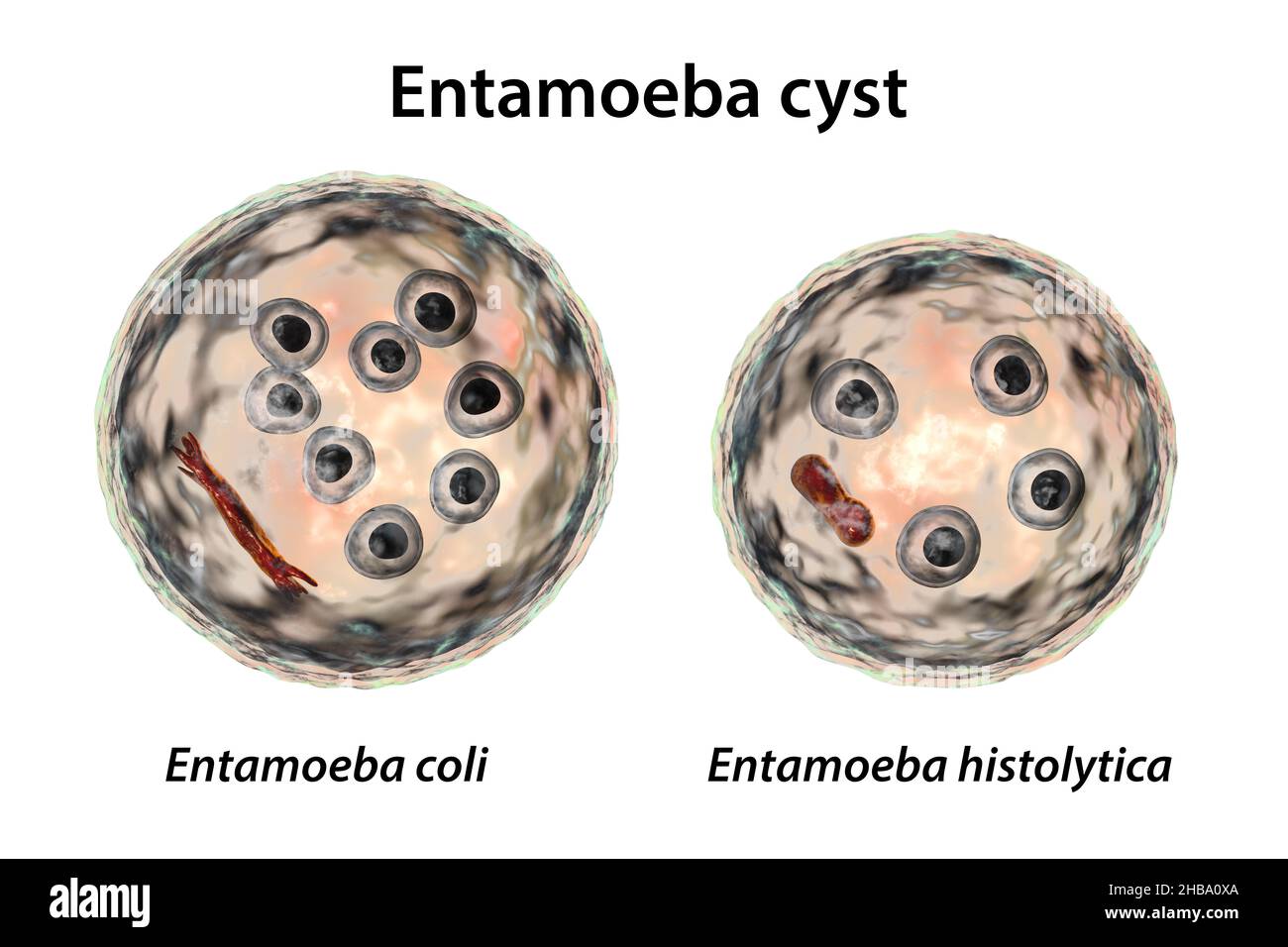 Zysten von Entamoeba-Protozoen, E. coli und E. histolityca, Computerdarstellung. E. coli ist eine nicht pathogene Amöbe, seine Zyste beträgt 15-25 Mikrometer, hat acht Kerne und einen chromatoidalen Balken, der mit splitterten Enden (dunkelrot) verlängert ist. E. histolytica ist ein parasitäres Protozoon, das beim Menschen nach der Einnahme von infektiösen Zysten in kontaminierten Lebensmitteln oder Wasser eine amöbische Dysenterie verursacht. Die reife Zyste von E. histolytica ist 10-20 Mikrometer groß, hat vier Kerne und einen gerundeten länglichen chromatoidalen Balken (dunkelrot). Stockfoto