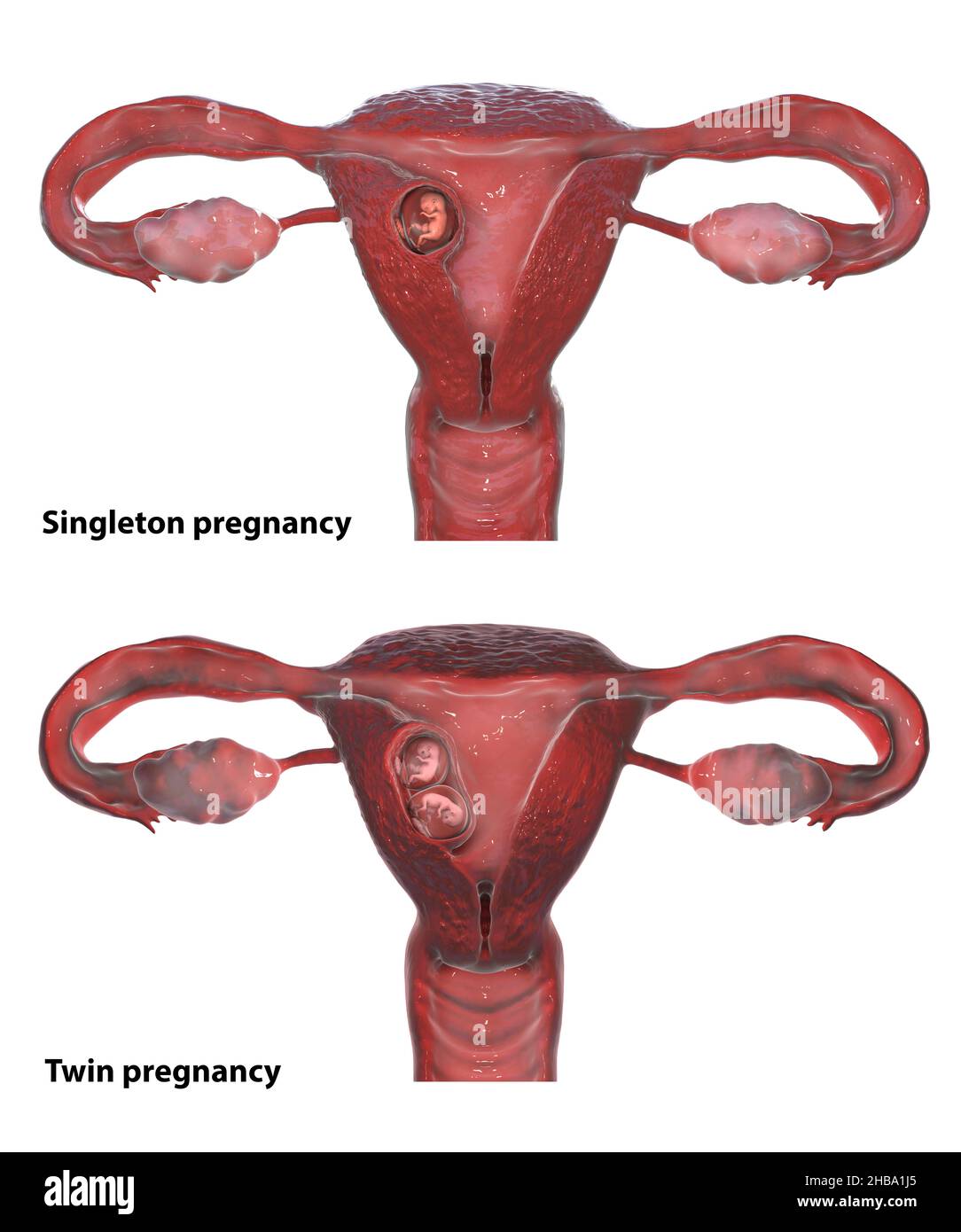 Singleton und Multiple Schwangerschaft, Computerdarstellung. Stockfoto