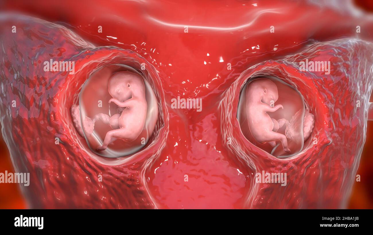Multiple Schwangerschaft, Illustration. Dizygotische Zwillinge entwickeln sich in Woche 8 getrennt in der Gebärmutter. Stockfoto