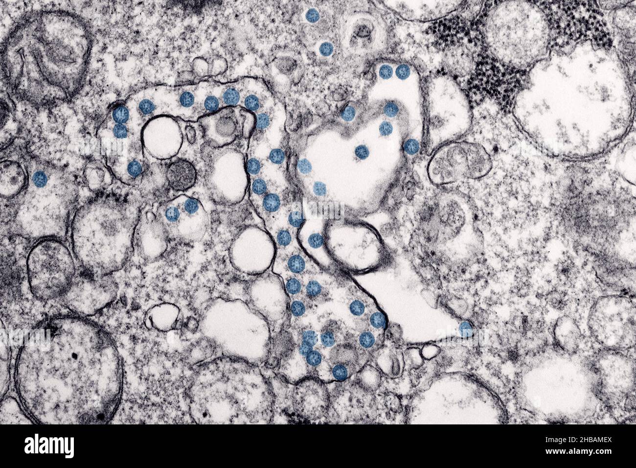 Transmissionselektronenmikroskopisches Bild eines Isolats aus dem ersten US-Fall von COVID-19, früher bekannt als 2019-nCoV. Die kugelförmigen viralen Partikel, blau gefärbt, enthalten Querschnitte durch das virale Genom, die als schwarze Punkte angesehen werden. Eine optimierte und verbesserte Version eines Bildes, das von den US Centers for Disease Control and Prevention produziert wurde / Credit: CDC / C.S. Goldschmied und A. Tamin Stockfoto