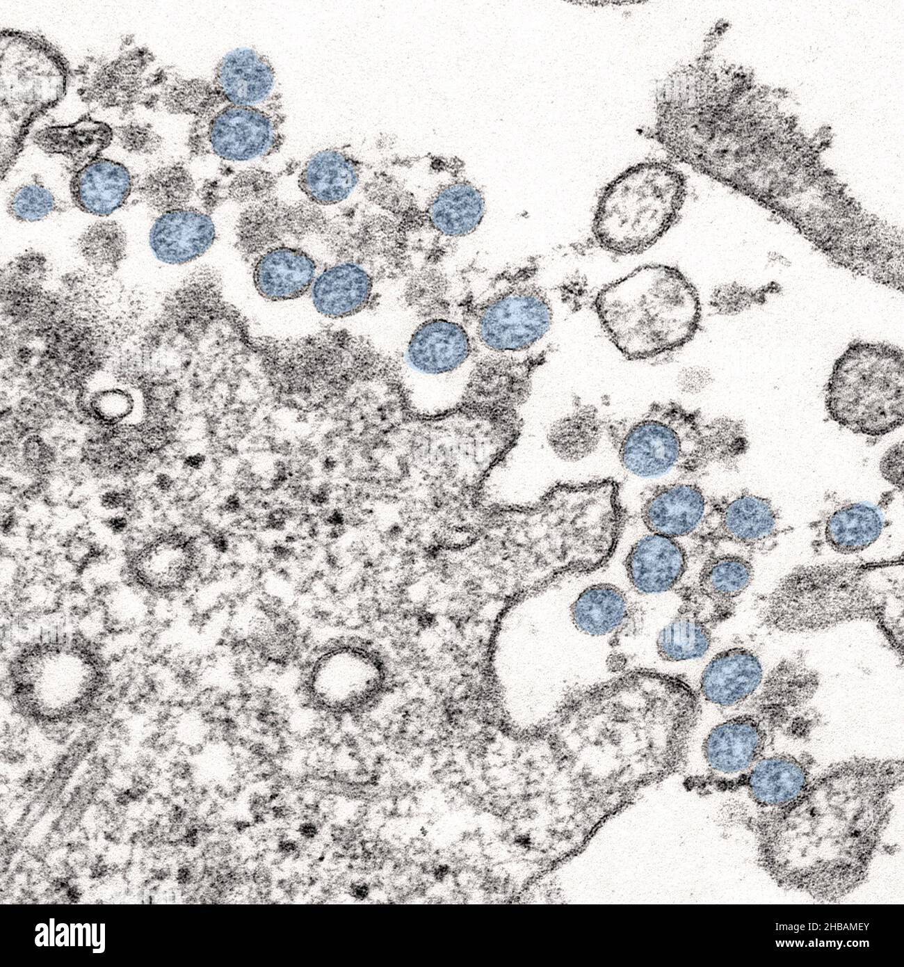 Transmissionselektronenmikroskopisches Bild eines Isolats aus dem ersten US-Fall von COVID-19, früher bekannt als 2019-nCoV. Die kugelförmigen viralen Partikel, blau gefärbt, enthalten Querschnitte durch das virale Genom, die als schwarze Punkte angesehen werden. Eine optimierte und verbesserte Version eines Bildes, das von den US Centers for Disease Control and Prevention produziert wurde / Credit: CDC / C.S. Goldschmied und A. Tamin Stockfoto