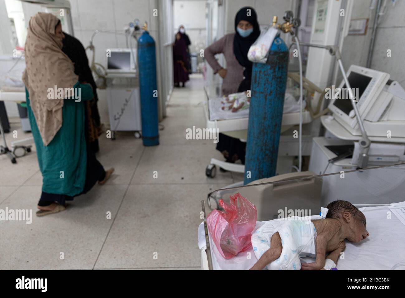 Indira Gandhi Kinderkrankenhaus in Kabul ist ein Kinderkrankenhaus in Afghanistan. Kinder unter 5 Jahren, die an Unterernährung leiden, werden ins Krankenhaus eingeliefert. Stockfoto