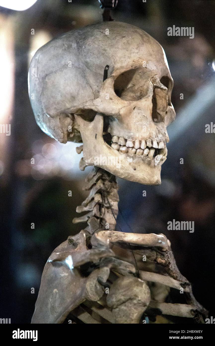 Menschliches Skelett, Nahaufnahme des Schädels (Old Operate Theatre Museum und Herb Garret, London, Großbritannien Stockfoto