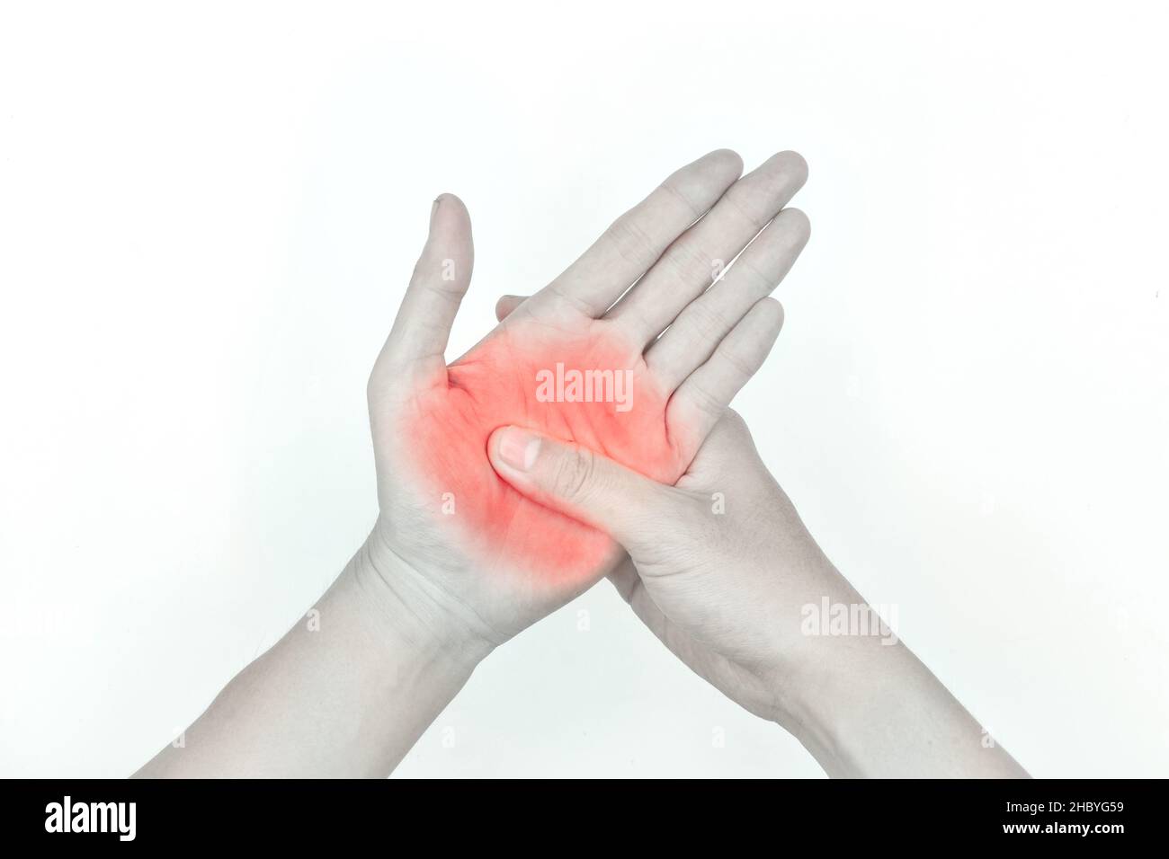 Schmerzhafter Palmar-Aspekt des asiatischen jungen Mannes. Konzept des Kompartiment-Syndroms, Zellulitis und Schmerzen der Handmuskulatur. Stockfoto