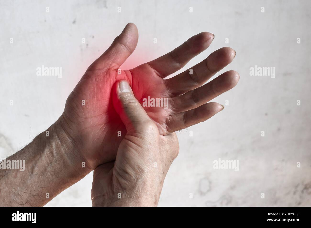 Schmerzhafter Palmaraspekt des asiatischen alten Mannes. Konzept des Kompartiment-Syndroms, Zellulitis und Schmerzen der Handmuskulatur. Stockfoto