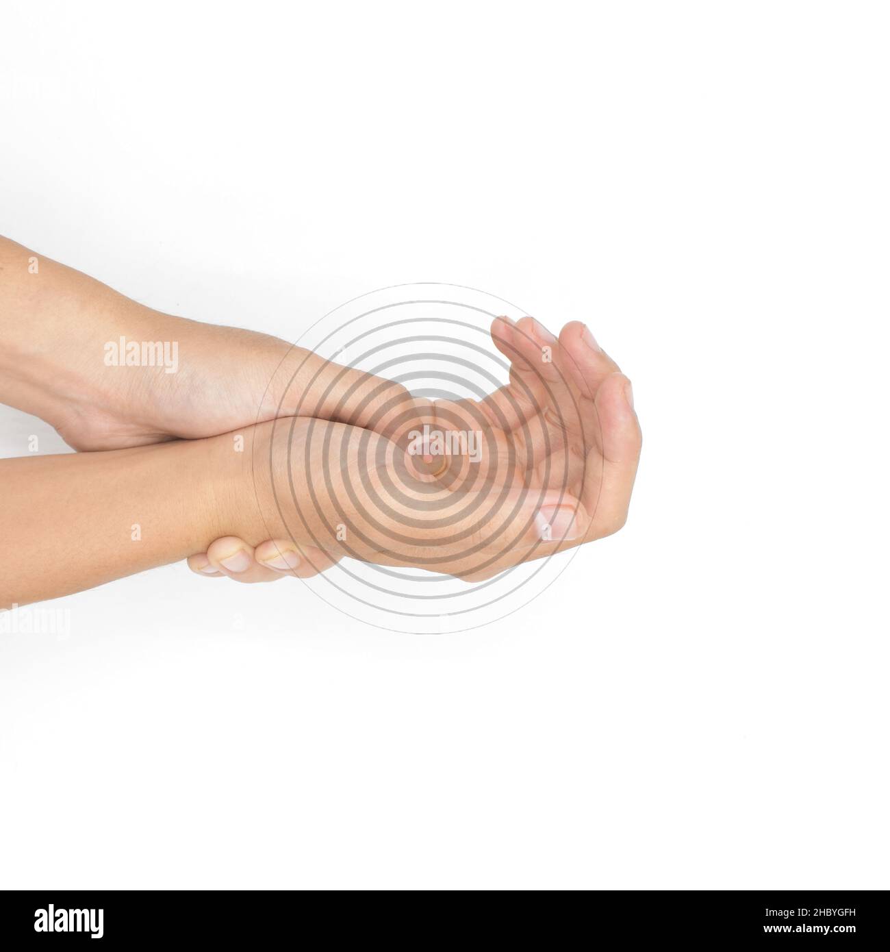 Schmerzhafter Palmar-Aspekt des asiatischen jungen Mannes. Konzept des Kompartiment-Syndroms und Schmerzen der Handmuskulatur. Stockfoto