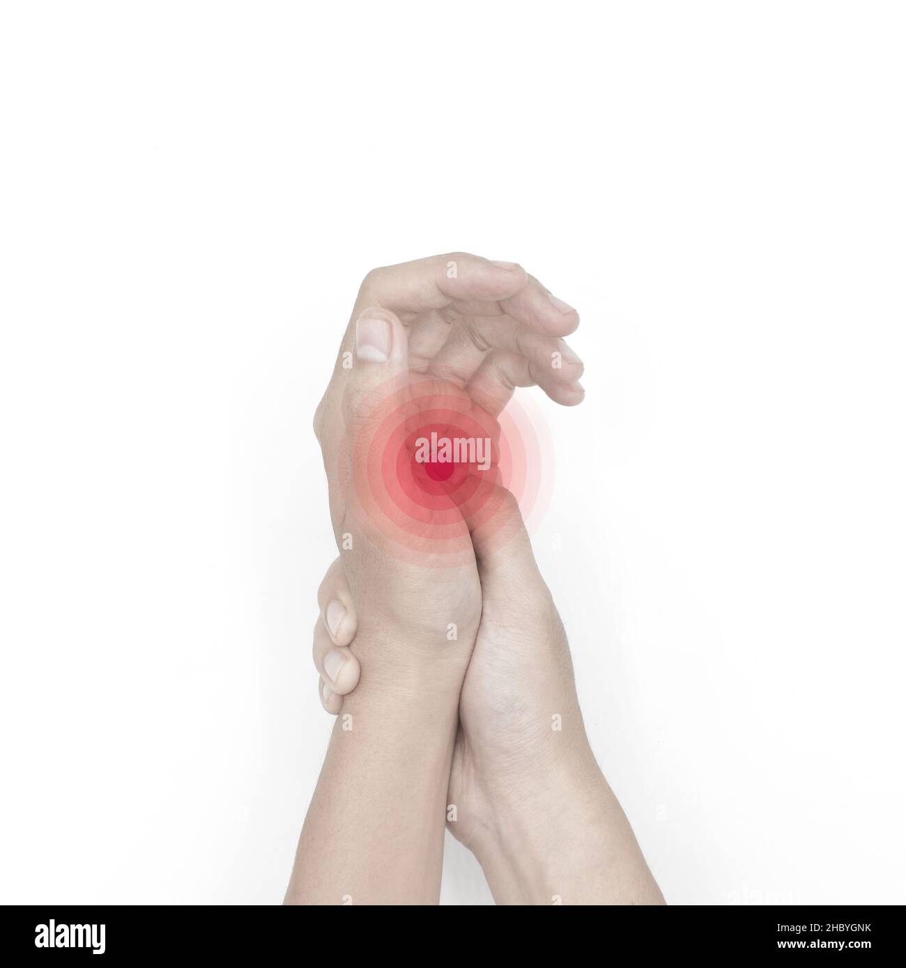 Schmerzhafter Palmar-Aspekt des asiatischen jungen Mannes. Konzept des Kompartiment-Syndroms und Schmerzen der Handmuskulatur. Stockfoto