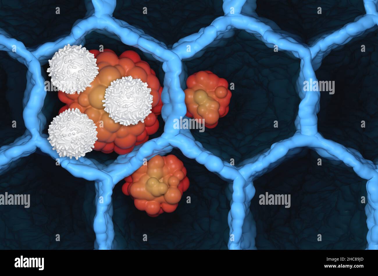 T-Zellen greifen kleinzellige Lungenkrebs an Tumor Mikrobiologie 3D Abbildung Draufsicht Stockfoto