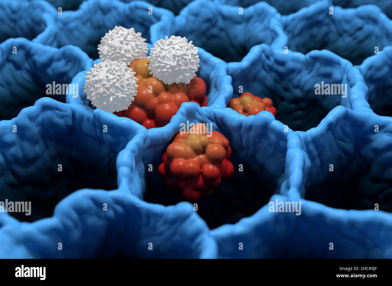 T-Zellen greifen kleinzellige Lungenkrebs an Tumor Mikrobiologie 3D Illustration isometrische Ansicht Stockfoto