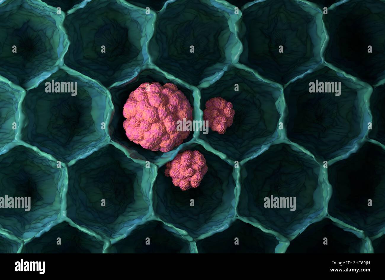 Lungenkrebs Tumor Mikrobiologie 3D Abbildung Draufsicht Stockfoto
