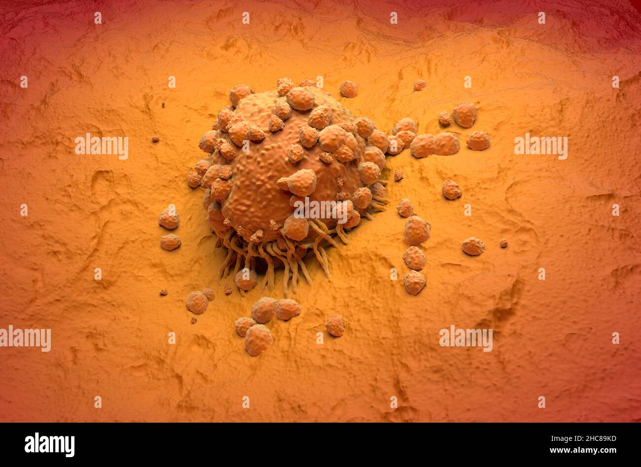 Melanomzelle eine Art von Hautkrebs isometrische Ansicht 3D Abbildung Stockfoto