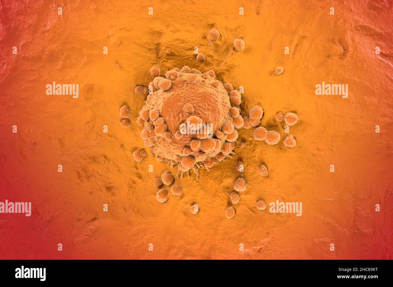Melanomzelle eine Art von Hautkrebs Draufsicht 3D Illustration Stockfoto