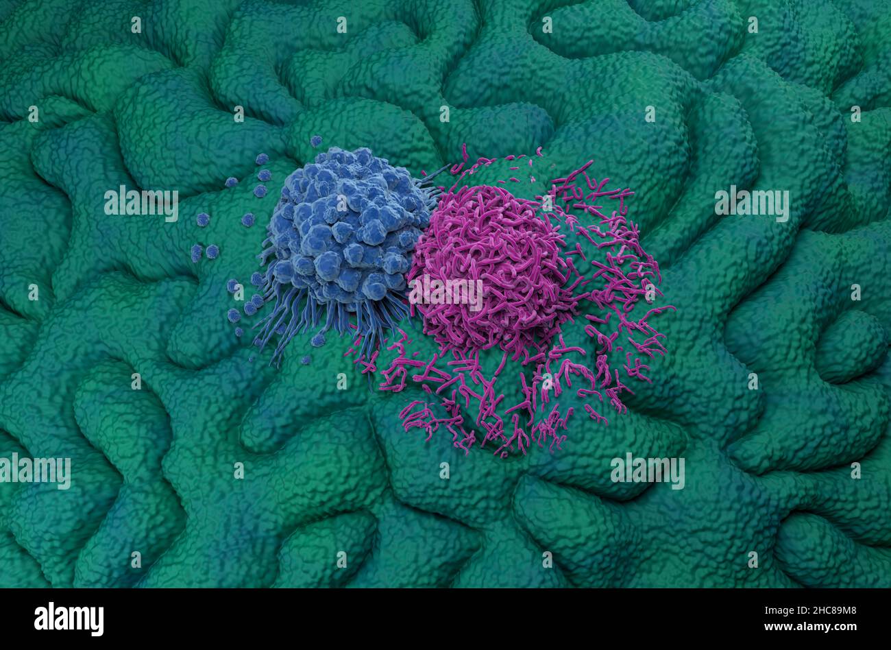 Magenkrebszellen isometrische Ansicht 3D Abbildung Stockfoto