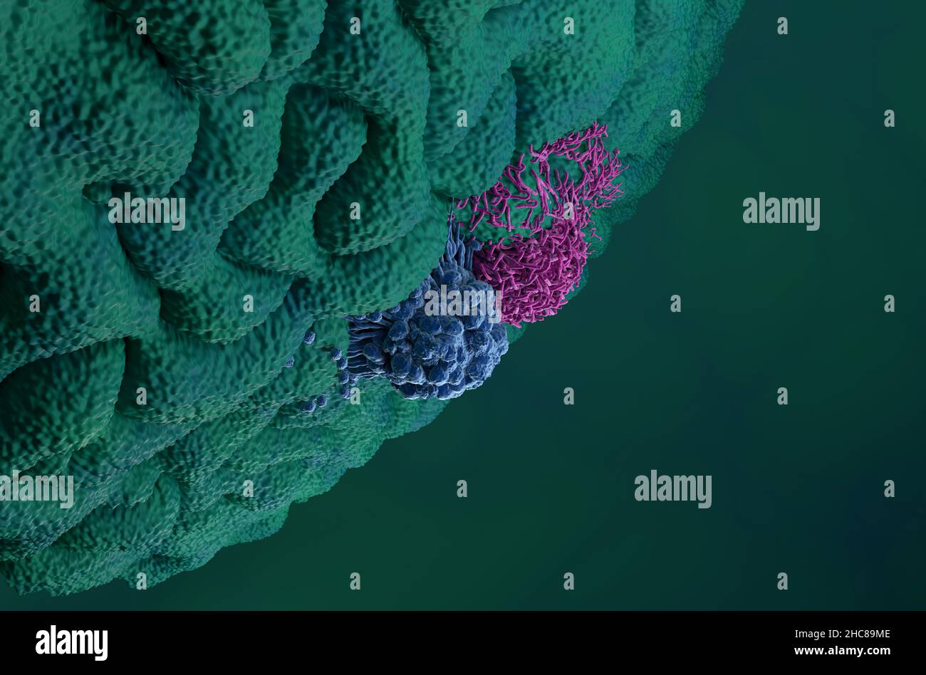 Magenkrebszellen in der unteren Ansicht 3D Abbildung Stockfoto