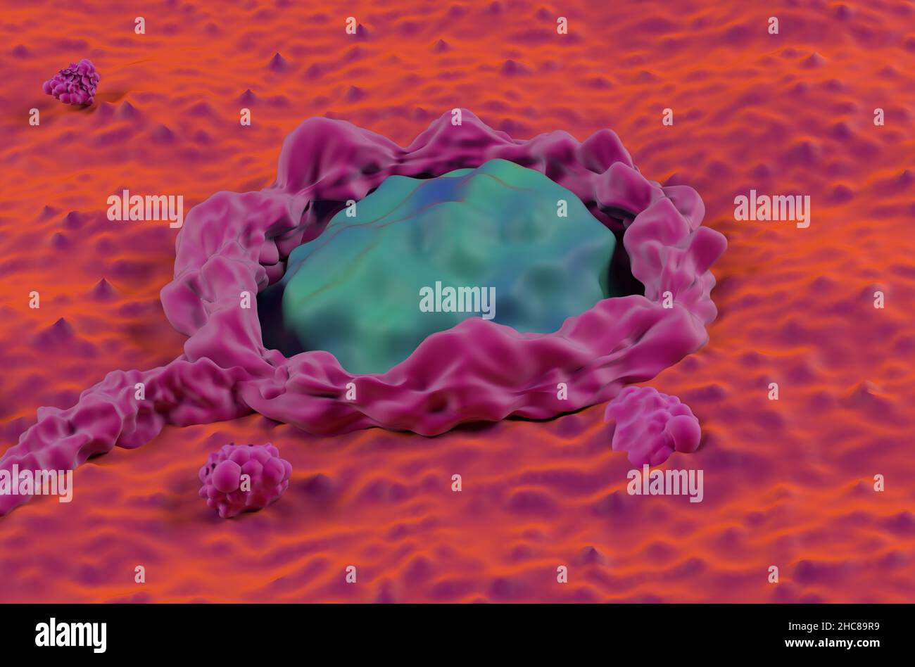 Cancer Colon Oberfläche super Makro kolorektalen Krebs Nahaufnahme Ansicht 3D Abbildung Stockfoto