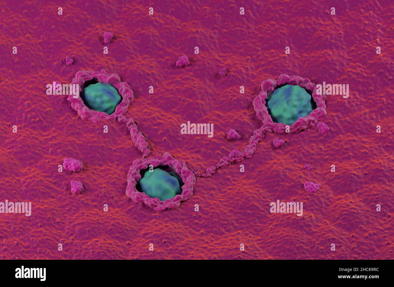 Cancerous colon surface super Makro kolorectal Cancer isometrische Ansicht 3D Abbildung Stockfoto