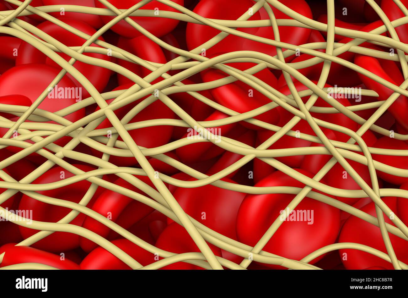 Blutgerinnsel. Die roten Blutkörperchen sind in Filamenten aus Fibrin-Protein gefangen. Isometrische Ansicht 3D Abbildung Stockfoto