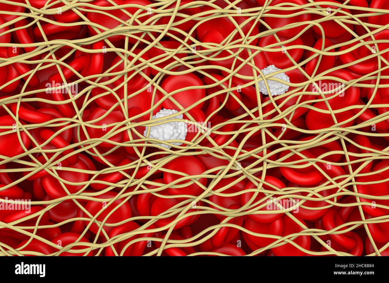 Blutgerinnsel. Die roten Blutkörperchen und weißen Blutkörperchen sind in Filamenten aus Fibrin-Protein gefangen. Isometrische Ansicht 3D Abbildung Stockfoto