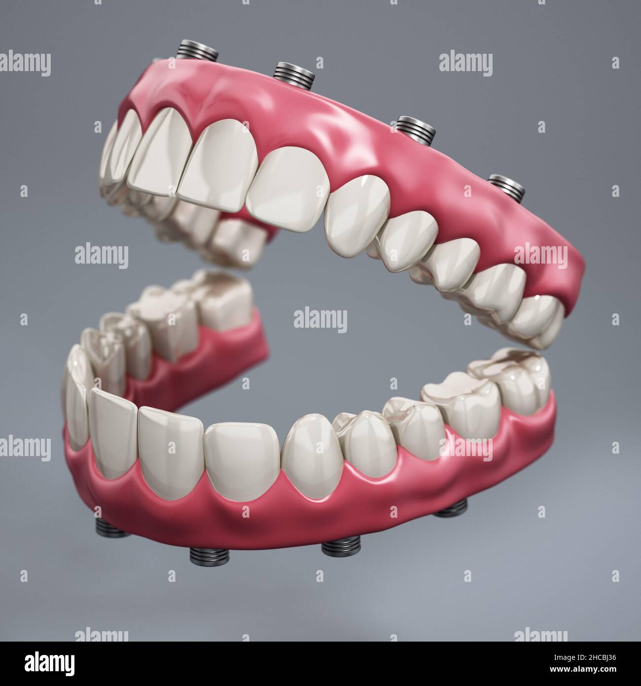 Zahnprothese isoliert auf grauem Hintergrund. 3D Abbildung. Stockfoto