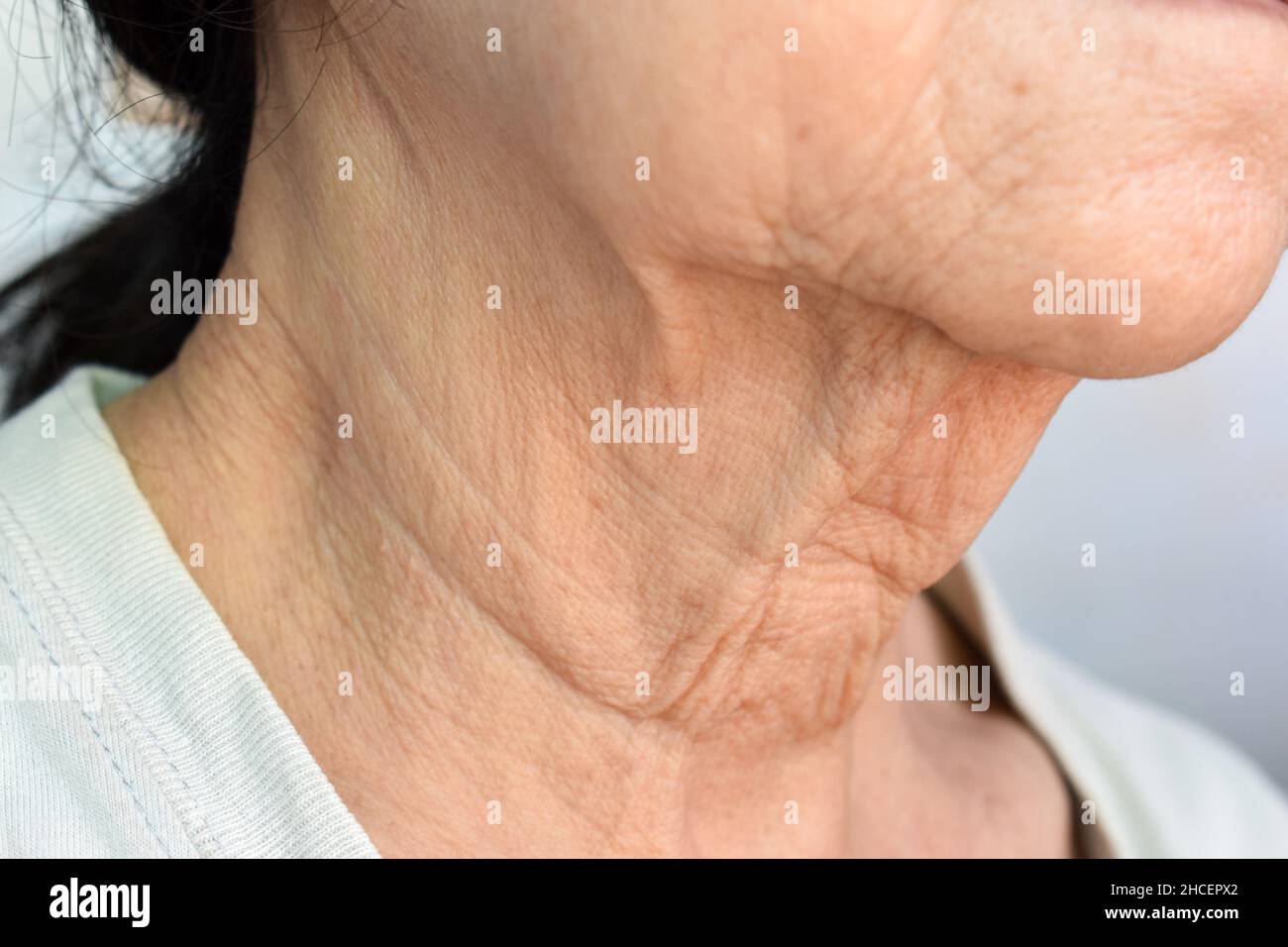 Alternde Hautfalten oder Hautfalten oder Falten am Hals südostasiatischer, chinesischer alter Frau. Stockfoto