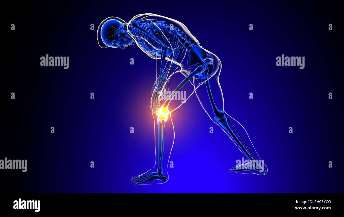 Anatomie der Kniegelenkschmerzen für Medical Concept 3D Illustration Stockfoto