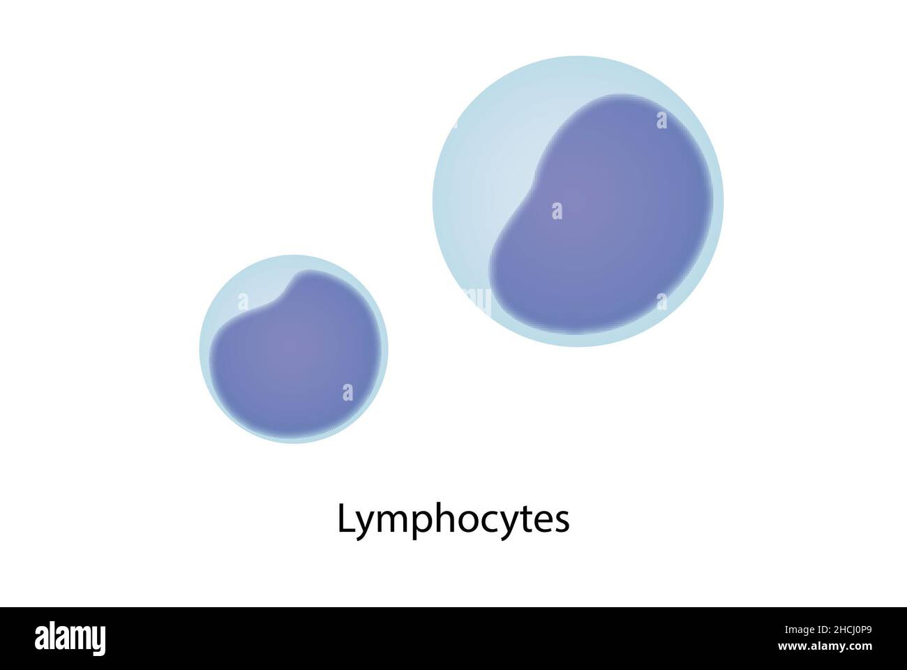Lymphozyten, Blutausstrich, große und kleine Lyphozyten. Stockfoto